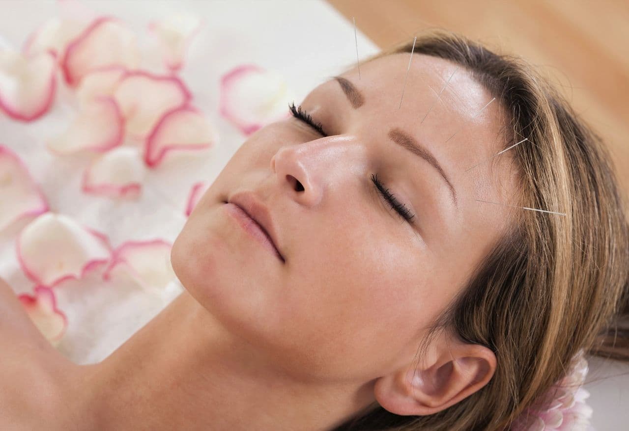 Facial Rejuvenation Acupuncture: Natural Alternative for Skin Care and Health