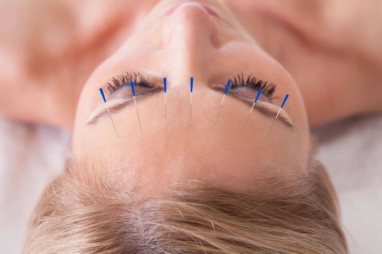 A close-up beauty photo related to facial acupuncture