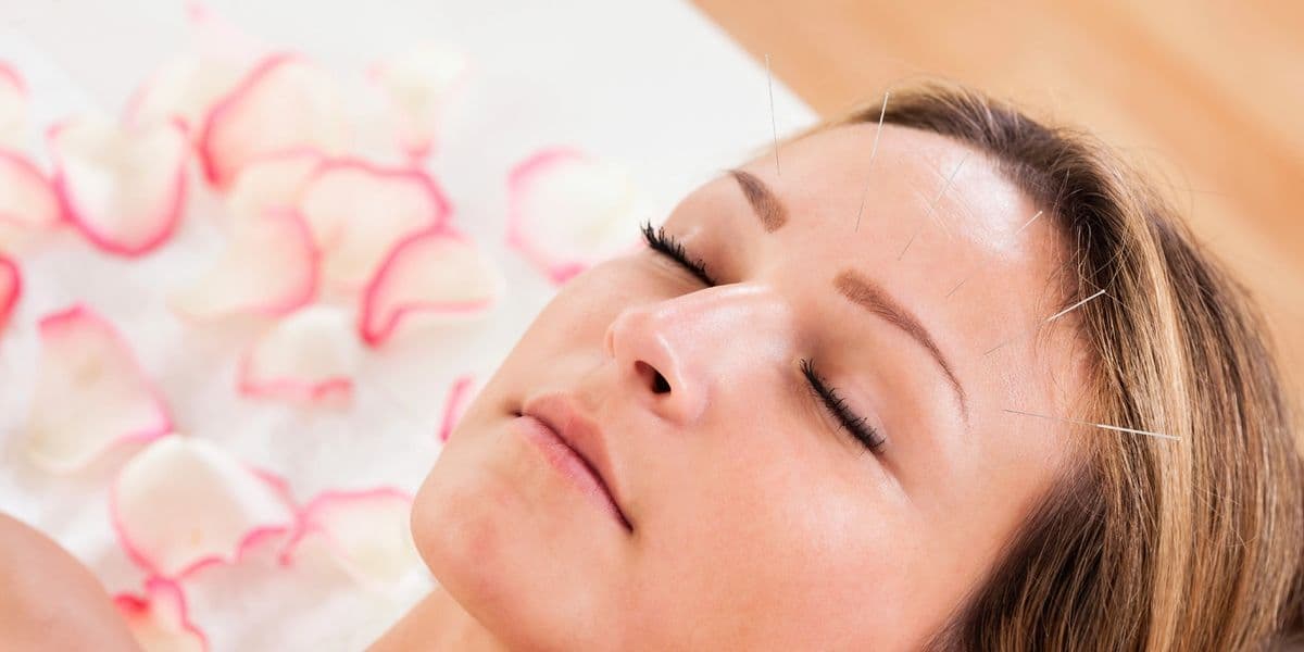 Woman undergoing facial cosmetic acupuncture treatment
