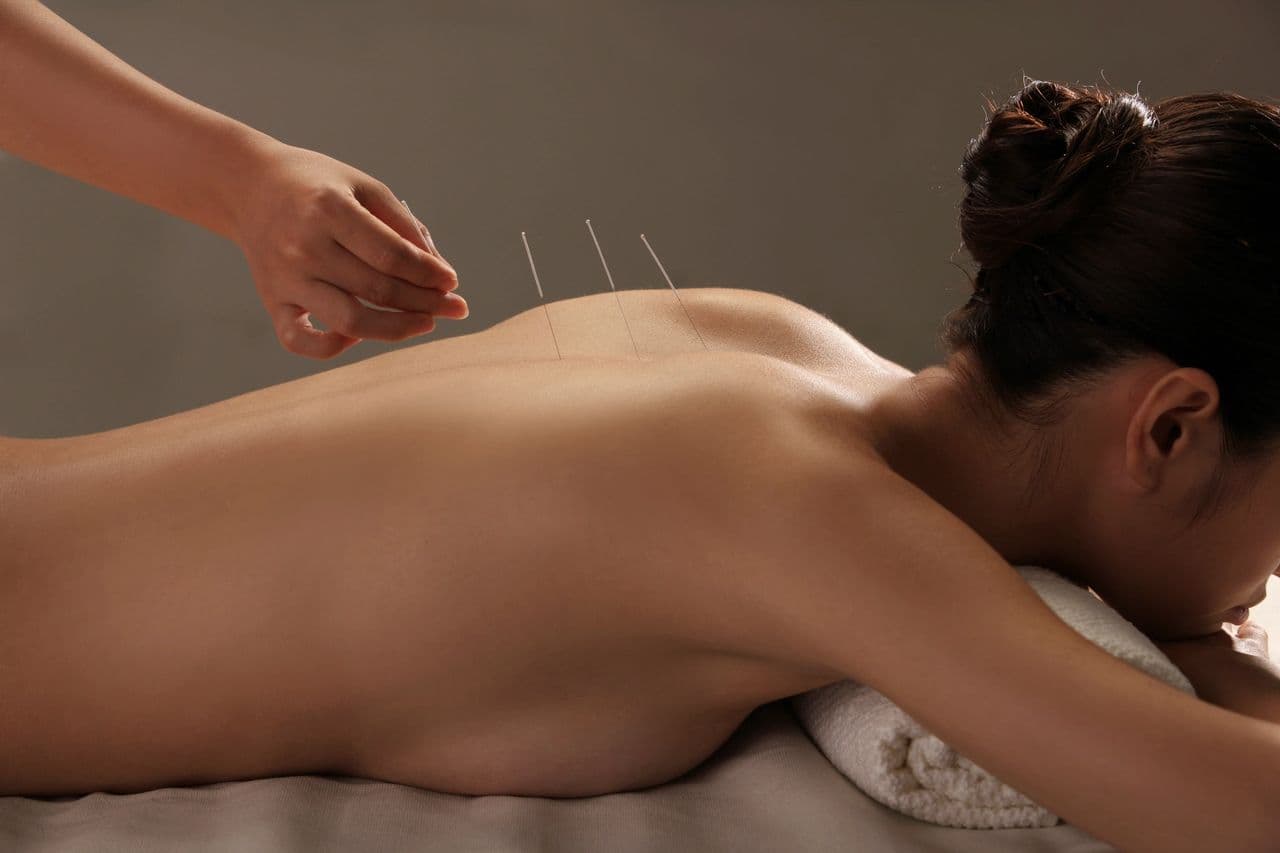 Fertility acupuncture